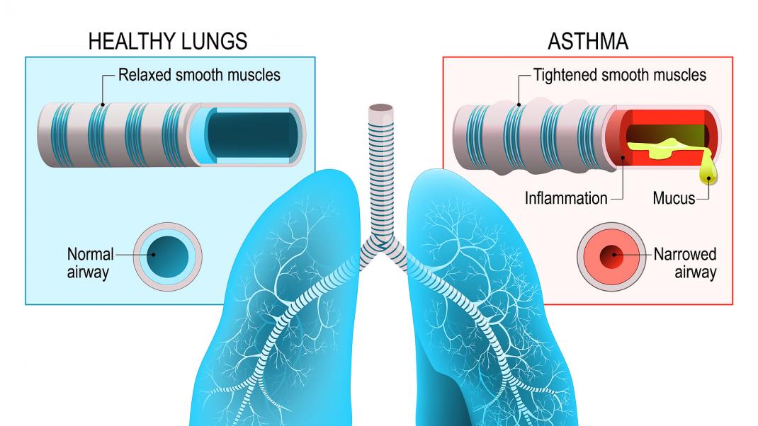 asthma provider pulmonologist